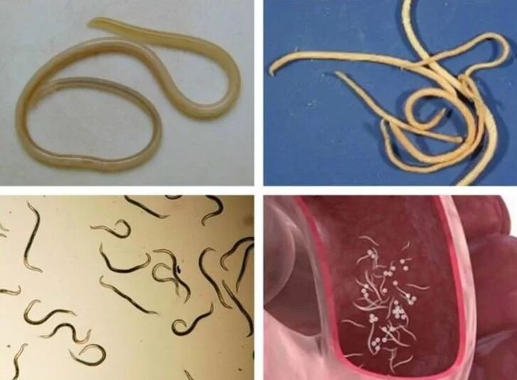 Helminths sa mga tao